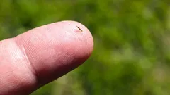 Splinter in je vinger? Zo krijg je hem er makkelijk en veilig uit